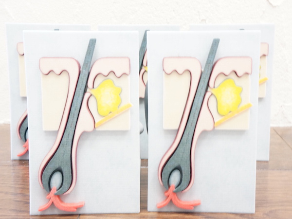 3Dプリント「患者様への治療プレゼンテーション用模型」