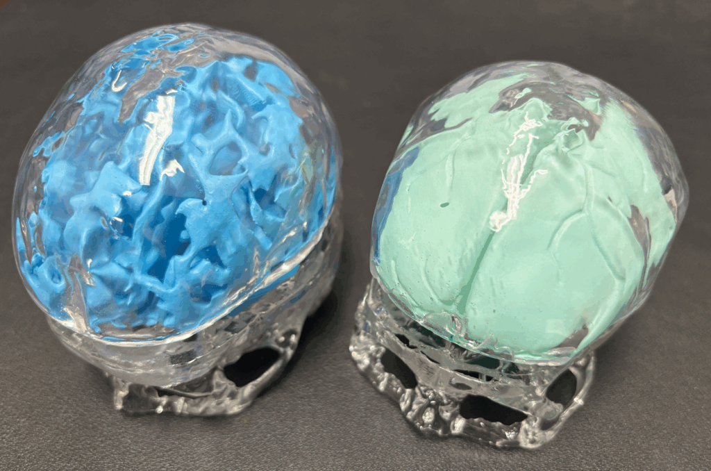 事例①脳の模型の画像